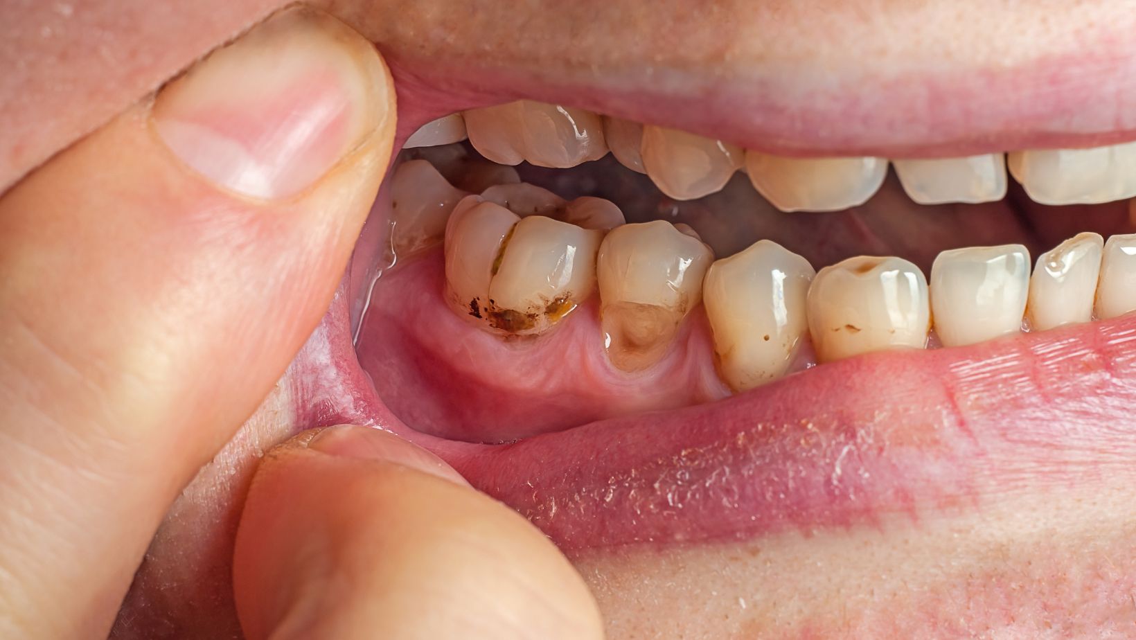 Image3
